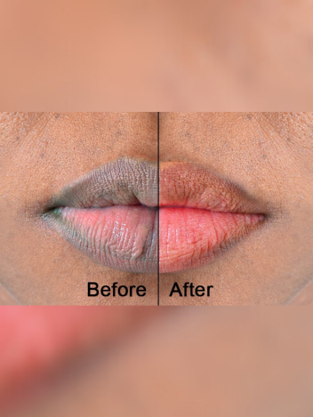 Lip Scrub for Naturally Red & Soft Lips