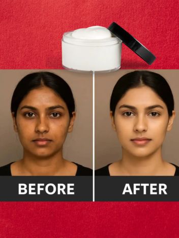 Face Whitening Cream result